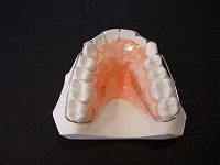 retainer