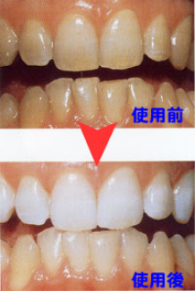 白く する 歯 なぜ歯が黄ばむ？審美歯科医が教える歯を白くする方法 [歯のホワイト二ング・口臭対策]